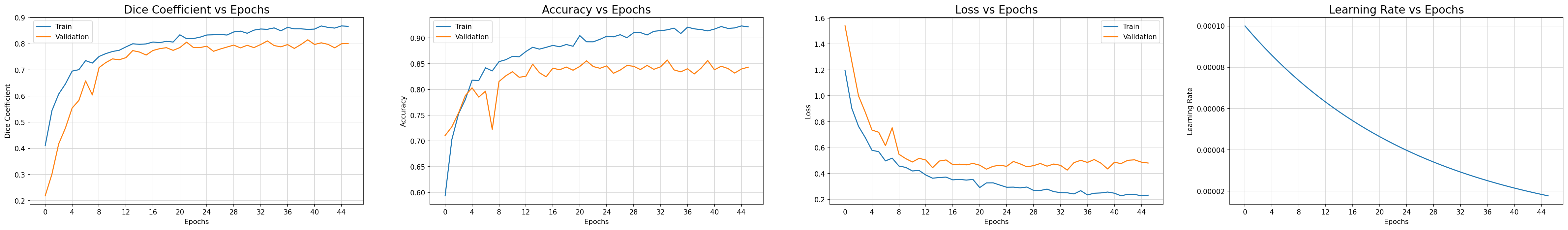 model_metrics_plot.png