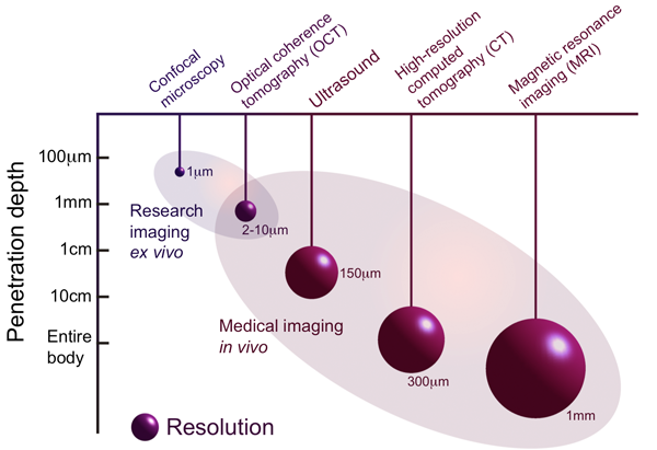 OCT VS MRI VS CT