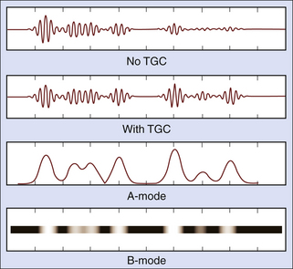 ultrasound b mode