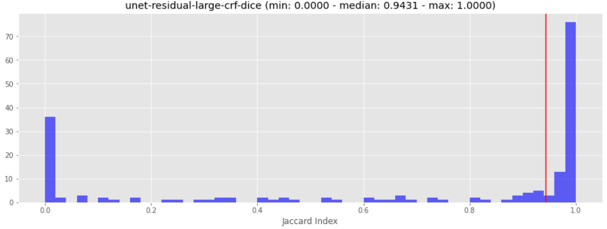 model-results-unet-residual-large-dice-with-crf.png