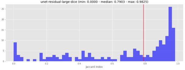 model-results-unet-residual-large-dice.png