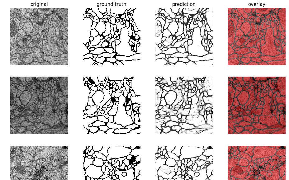 plotted images, masks and predictions